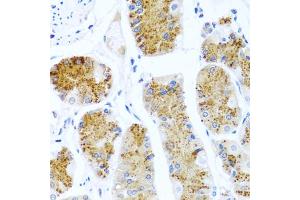 Immunohistochemistry of paraffin-embedded human stomach using C8orf4 antibody (ABIN5975014) at dilution of 1/100 (40x lens). (C8orf4 anticorps)