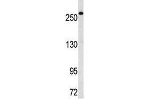 Western blot analysis of FASN antibody in Ramos lysate.