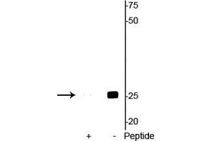 Western blot of mouse heart lysate showing specific immunolabeling of the ~25 kDa cardiac troponin I protein phosphorylated at Ser23/24 in the second lane (-). (TNNI3 anticorps  (pSer23, pSer24))