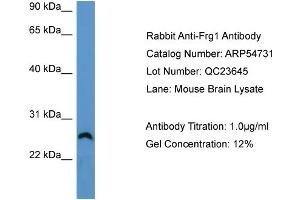 WB Suggested Anti-Frg1  Antibody Titration: 0. (FRG1 anticorps  (Middle Region))