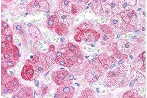 Human Adrenal: Formalin-Fixed, Paraffin-Embedded (FFPE)