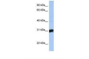 Image no. 1 for anti-UDP-Gal:betaGal beta 1,3-Galactosyltransferase Polypeptide 6 (B3GALT6) (AA 254-303) antibody (ABIN6739270)