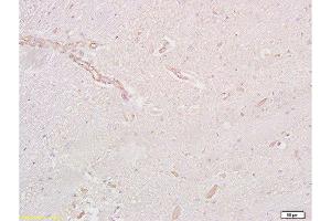 Formalin-fixed and paraffin embedded rat brain tissue labeled with Anti-GLP-1R Polyclonal Antibody, Unconjugated  at 1:200 followed by conjugation to the secondary antibody and DAB staining (GLP1R anticorps  (AA 101-200))