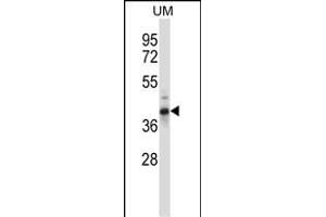 OAF Antibody (N-term) (ABIN658025 and ABIN2846963) western blot analysis in human uterine tumor tissue lysates (35 μg/lane).