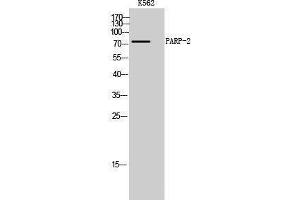 Western Blotting (WB) image for anti-Poly (ADP-Ribose) Polymerase 2 (PARP2) (Internal Region) antibody (ABIN3186334) (PARP2 anticorps  (Internal Region))