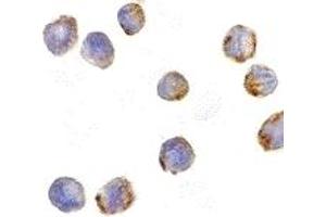 Western Blotting (WB) image for anti-MDM2 Binding Protein (MTBP) (Middle Region 2) antibody (ABIN1031200) (MTBP anticorps  (Middle Region 2))