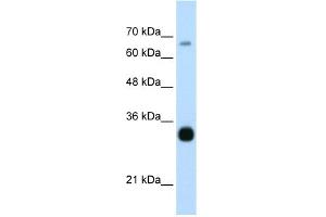 WB Suggested Anti-THOC3 Antibody Titration:  0. (THO Complex 3 anticorps  (Middle Region))