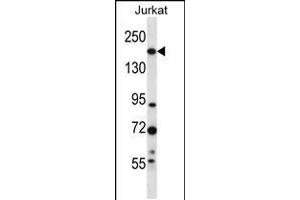 Western blot analysis in Jurkat cell line lysates (35ug/lane). (UGGT1 anticorps  (C-Term))