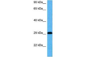 Host:  Mouse  Target Name:  CDX2  Sample Tissue:  Mouse Skeletal Muscle  Antibody Dilution:  1ug/ml (CDX2 anticorps  (Middle Region))