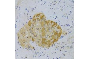 Immunohistochemistry of paraffin-embedded human rectum using PA2G4 Antibody (ABIN5973112) at dilution of 1/100 (40x lens). (PA2G4 anticorps)