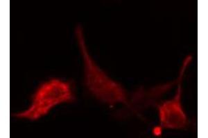ABIN6274769 staining LOVO cells by IF/ICC. (RPL15 anticorps  (C-Term))
