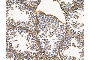 ABIN6263627 and ABIN6272360 at 1/100 staining mouse testis tissue by IHC-P.