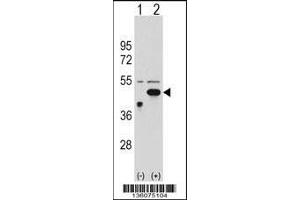 Western blot analysis of ETNK2 using rabbit polyclonal ETNK2 Antibody using 293 cell lysates (2 ug/lane) either nontransfected (Lane 1) or transiently transfected (Lane 2) with the ETNK2 gene.
