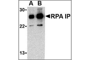 Western blot analysis of RPA Interacting Protein in Jurkat cell lysate with this product at (A) 0. (RPAIN anticorps  (C-Term))