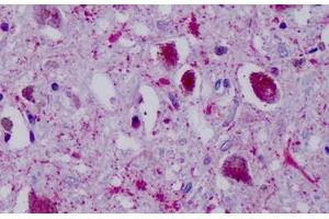 Anti-PPYR1 antibody IHC staining of human brain, substania nigra. (NPY4R anticorps  (Cytoplasmic Domain))