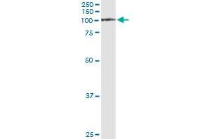 Immunoprecipitation of FAP transfected lysate using anti-FAP monoclonal antibody and Protein A Magnetic Bead , and immunoblotted with FAP MaxPab rabbit polyclonal antibody.