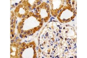 Immunohistochemical analysis of paraffin-embedded human kidney section using VEGFR3 antibody at 1:25 dilution.