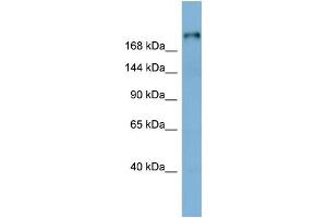 WB Suggested Anti-LAMB1 Antibody Titration:  0. (Laminin beta 1 anticorps  (Middle Region))