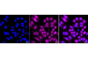 Immunocytochemical staining of HepG2 cells with Angio associated migratory cell protein antibody (ABIN7797601), 1:).