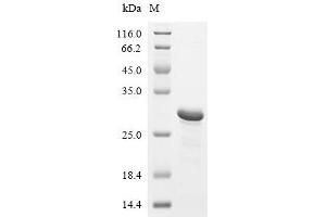 (Tris-Glycine gel) Discontinuous SDS-PAGE (reduced) with 5 % enrichment gel and 15 % separation gel.