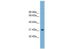 WB Suggested Anti-Gm5864 Antibody Titration:  0. (Gm5864 anticorps  (Middle Region))