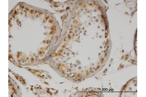 Immunoperoxidase of monoclonal antibody to IL13 on formalin-fixed paraffin-embedded human testis.