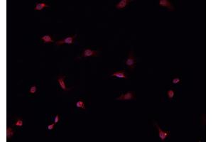 ABIN6266520 staining HeLa  cells by IF/ICC.