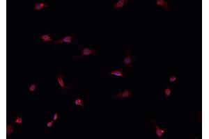 ABIN6266520 staining HeLa  cells by IF/ICC. (Cullin 1 anticorps)