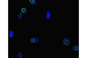 CLCN1 antibody  (AA 634-988)