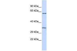 WB Suggested Anti-TRIM8 Antibody Titration:  0. (TRIM8 anticorps  (Middle Region))