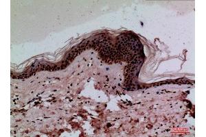 Immunohistochemistry (IHC) analysis of paraffin-embedded Human Skin, antibody was diluted at 1:100. (CEACAM1/5 anticorps  (N-Term))