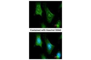 ICC/IF Image Immunofluorescence analysis of methanol-fixed HeLa, using PTS, antibody at 1:100 dilution.