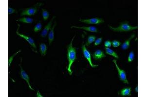 Immunofluorescent analysis of Hela cells using ABIN7146338 at dilution of 1:100 and Alexa Fluor 488-congugated AffiniPure Goat Anti-Rabbit IgG(H+L)