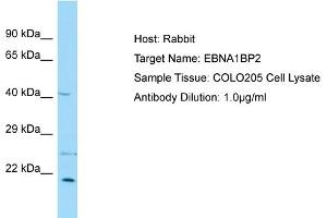 Host: Rabbit Target Name: EBNA1BP2 Sample Type: COLO205 Whole Cell lysates Antibody Dilution: 1. (EBNA1BP2 anticorps  (Middle Region))