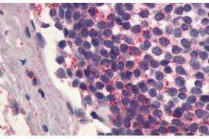 Image no. 1 for anti-Sphingosine-1-Phosphate Receptor 4 (S1PR4) (C-Term) antibody (ABIN1048533)