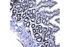 anti-Chromobox Homolog 3 (CBX3) (AA 2-183) antibody