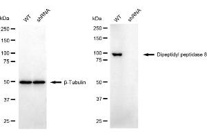 Western blotting analysis using dipeptidyl peptidase 8 antibody (ABIN7798346).