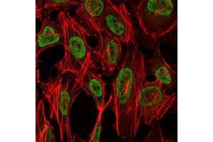 Immunofluorescence analysis of NIH/3T3 cells using PSIP1 mouse mAb (green). (PSIP1 anticorps)