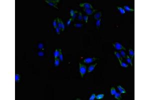 Immunofluorescent analysis of HepG2 cells using ABIN7143036 at dilution of 1:100 and Alexa Fluor 488-congugated AffiniPure Goat Anti-Rabbit IgG(H+L)