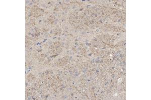 IHC analysis of SLC25A23 using anti-SLC25A23 antibody (ABIN7600165).