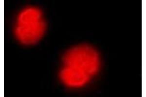 Immunofluorescent analysis of CaMK4 staining in Jurkat cells.