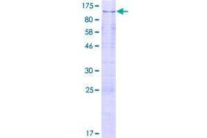 Image no. 1 for Zinc Finger Protein 280C (ZNF280C) (AA 1-737) protein (GST tag) (ABIN1326069)