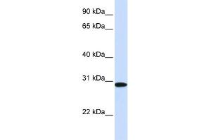 WB Suggested Anti-MTHFD2 Antibody Titration:  0. (MTHFD2 anticorps  (N-Term))