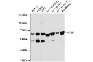 Western blot analysis of extracts of various cell lines, using PKLR antibody (ABIN6128469, ABIN6145710, ABIN6145712 and ABIN6215656) at 1:3000 dilution. (PKLR anticorps  (AA 446-556))