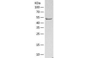 Western Blotting (WB) image for Hydroxyacyl-Coenzyme A Dehydrogenase/3-Ketoacyl-Coenzyme A Thiolase/enoyl-Coenzyme A Hydratase (Trifunctional Protein), alpha Subunit (HADHA) (AA 488-763) protein (His-IF2DI Tag) (ABIN7123379)
