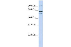 WB Suggested Anti-ABCE1 Antibody Titration:  0.