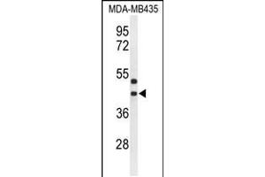 Western blot analysis of GPR17 Antibody in MDA-MB435 cell line lysates (35ug/lane) (GPR17 anticorps  (AA 230-258))
