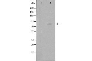 Western blot analysis of extracts from K562 cells using TFE3 antibody. (TFE3 anticorps  (Internal Region))