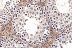 Immunohistochemistry analysis of paraffin-embedded mouse testis using ACE (ABIN7073050) at dilution of 1: 1000 (Angiotensin Converting Enzyme 1 anticorps)