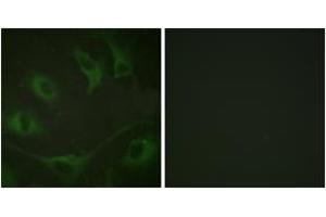 Immunofluorescence analysis of A549 cells, using CBL (Phospho-Tyr774) Antibody. (CBL anticorps  (pTyr774))